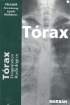 TORAX. DIAGNOSTICO RADIOLOGICO (RESIDENTE17)