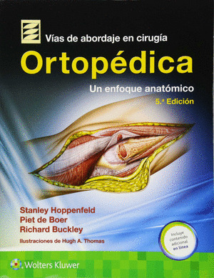VIAS DE ABORDAJE CIRUGIA ORTOPEDICA