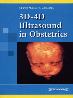 3D - 4D ULTRASOUND IN OBSTETRICS