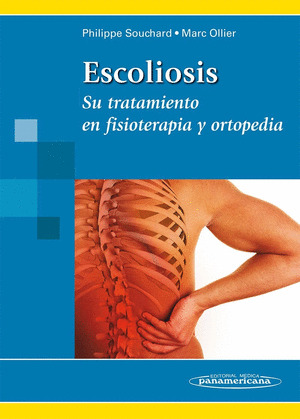 ESCOLIOSIS