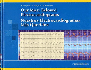 BRUGADA:ELECTROCARDIOGRAMAS