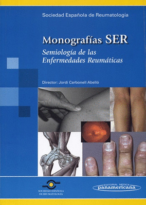 SEMIOLOGÍA DE LAS ENFERMEDADES REUMÁTICAS