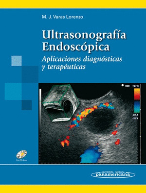 ULTRASONOGRAFÍA ENDOSCÓPICA