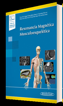 RESONANCIA MAGNETICA MUSCULOESQUELETICA