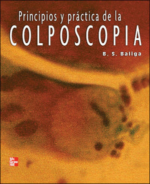 PRINCIPIOS Y PRACTICA DE LA COLPOSCOPIA