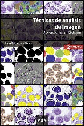 TÉCNICAS DE ANÁLISIS DE IMAGEN