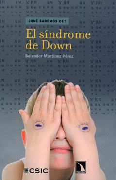 EL SÍNDROME DE DOWN