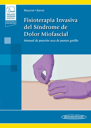FISIOTERAPIA INVASIVA DEL SÍNDROME DE DOLOR MIOFASCIAL+EBOOK