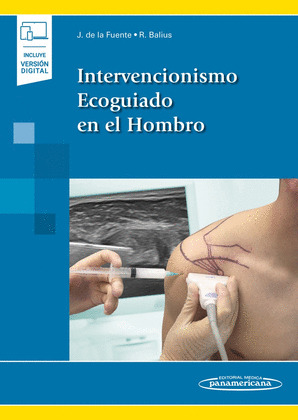 INTERVENCIONISMO ECOGUIADO EN EL HOMBRO.