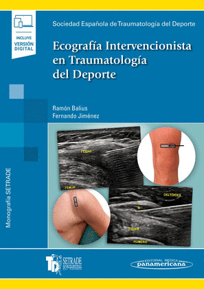 ECOGRAFIA INTERV.TRAUM.DEPORTE+E