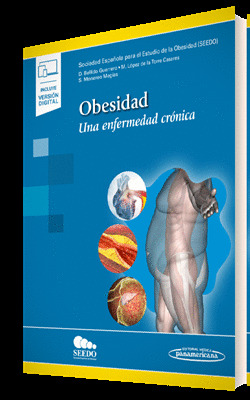 OBESIDAD DE SEEDO, UNA ENFERMEDAD CRONICA ( DÚO: PAPEL + DIGITAL)