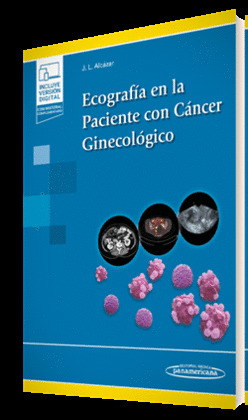 ECOGRAFÍA EN LA PACIENTE CON CÁNCER GINECOLÓGICO