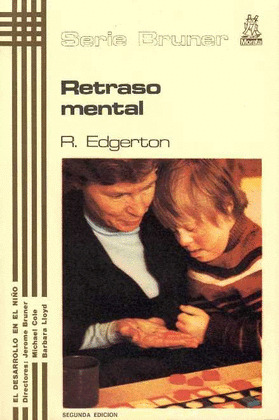 RETRASO MENTAL