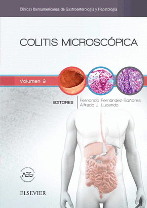 COLITIS MICROSCOPICA