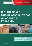 INFILTRACIONES MUSCULOESQUELETICAS GUIADAS POR ECOGRAFIA