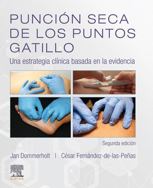 PUNCION SECA DE LOS PUNTOS GATILLO (2ª ED.)