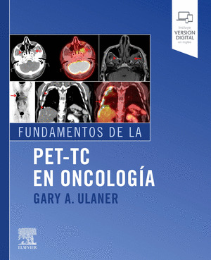 FUNDAMENTOS DE LA PET-TC EN ONCOLOGIA