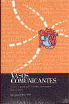 VASOS COMUNICANTES