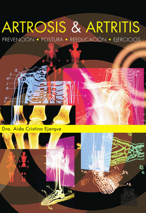 ARTROSIS & ARTRITIS. PREVENCIÓN, POSTURA, REEDUCACIÓN Y EJERCICIOS (BICOLOR).