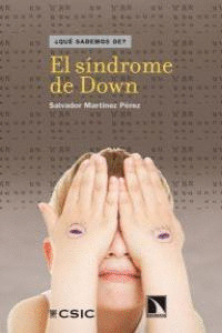 SÍNDROME DE DOWN, EL