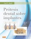 PRÓTESIS DENTAL SOBRE IMPLANTES