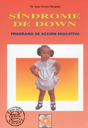SINDROME DE DOWN. PROGRAMA DE ACCION EDUCATIVA