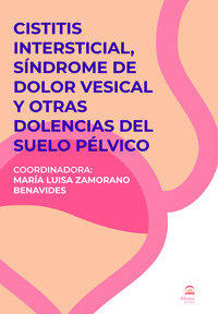 CISTITIS INTERSTICIAL, SINDROME DE DOLOR VESICAL
