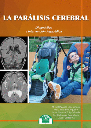 PARÁLISIS CEREBRAL,LA