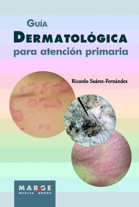 GUIA DERMATOLOGICA PARA ATENCION PRIMARIA