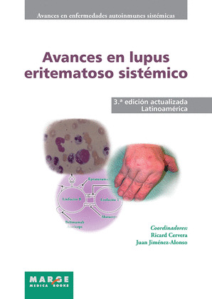 AVANCES EN LUPUS ERITEMATOSO SISTÉMICO