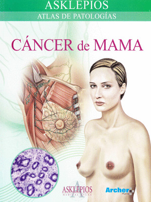 CÁNCER DE MAMA
