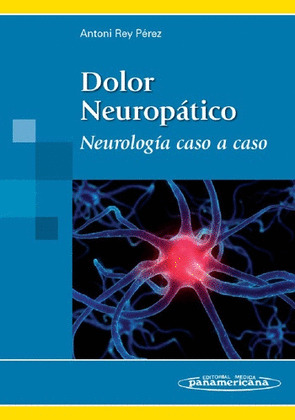 REY:DOLOR NEUROP?TICO CASO A CASO