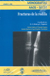 FRACTURAS DE RODILLA