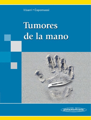TUMORES DE LA MANO