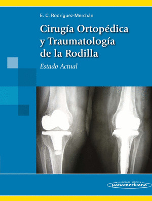 CIRUGÍA ORTOPÉDICA Y TRAUMATOLÓGICA DE LA RODILLA