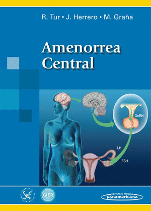 AMENORREA CENTRAL