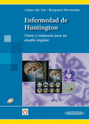 ENFERMEDAD DE HUNTINGTON