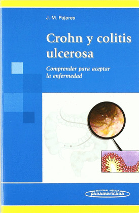 CROHN Y COLITIS ULCEROSA. COMPRENDER PARA ACEPTAR LA ENFERMEDAD