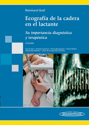ECOGRAFIA DE LA CADERA EN EL LACTANTE. SU IMPORTANCIA DIAGNOSTICA Y TERAPEUTICA