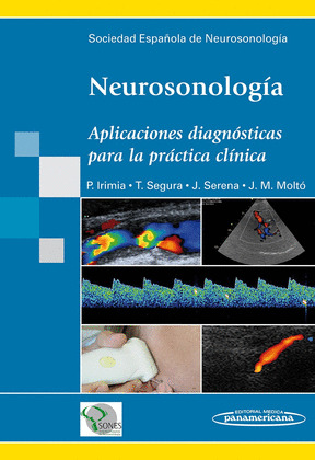 NEUROSONOLOGÍA