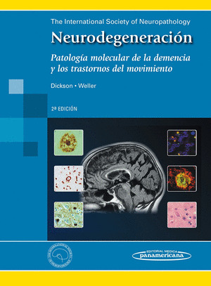 NEURODEGENERACIÓN