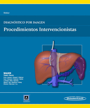DIAGNOSTICO POR IMAGEN. PROCEDIMIENTOS INTERVENCIONISTAS (WALKER)