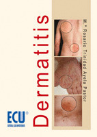 DERMATITIS
