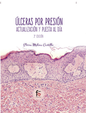 ULCERAS POR PRESION. ACTUALIZACION Y PUESTA AL DIA-3ª EDICIO