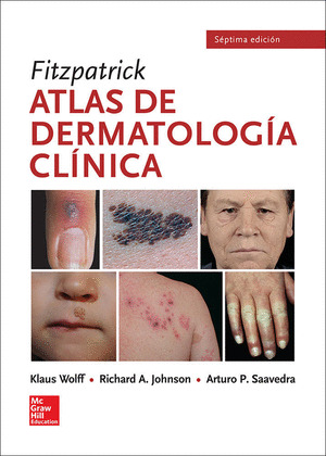 FITZPATRICK: ATLAS DE DERMATOLOGÍA CLÍNICA