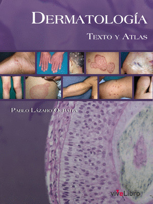 DERMATOLOGÍA.