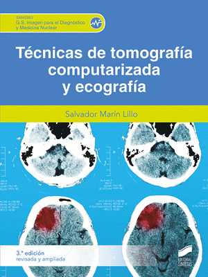 TECNICAS DE TOMOGRAFIA COMPUTERIZADA (3.ª EDICION REVISADA Y AMPLIADA)