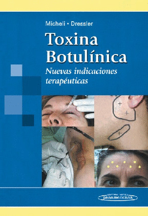 TOXINA BOTUL?NICA