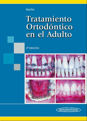 HARFIN:TRATAMIENTO ORTOD?N. ADULTO 2ED.