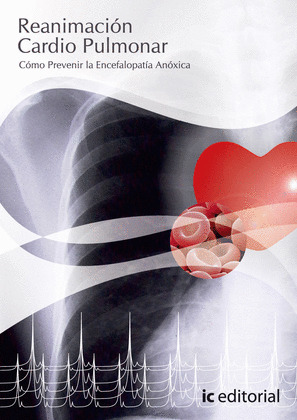 REANIMACIÓN CARDIO PULMONAR (CÓMO PREVENIR LA ENCEFALOPATÍA ANÓXI